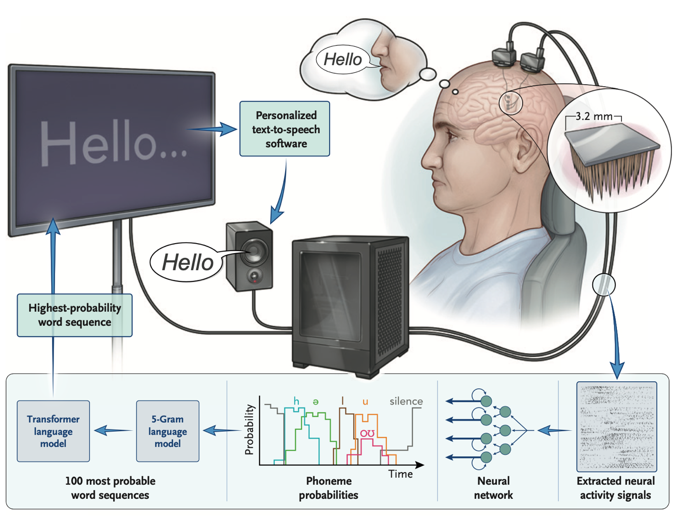Speech neuroprosthesis overview